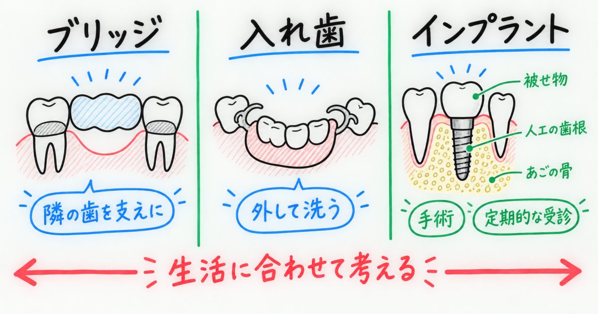 ブリッジ・入れ歯・インプラントは何を基準に考える?